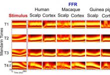 猴子 豚鼠和以英語為母語的人對語音的大腦反應(yīng)非常相似