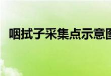 咽拭子采集點示意圖(咽拭子采樣點示意圖)