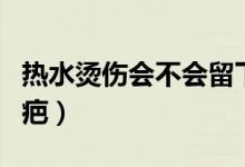 熱水燙傷會(huì)不會(huì)留下疤痕（熱水燙傷會(huì)不會(huì)留疤）