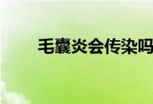 毛囊炎會(huì)傳染嗎（毛囊炎會(huì)傳染嗎）