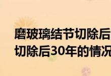 磨玻璃結(jié)節(jié)切除后30年存活率（磨玻璃結(jié)節(jié)切除后30年的情況）